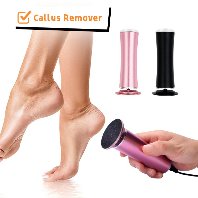 Callus remover use case